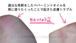 スイートアーモンドオイルとペパーミント精油でアロマイルを適当な希釈をして作ったことで、炎症が起きた話。