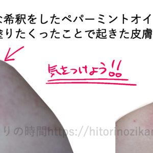 スイートアーモンドオイルとペパーミント精油でアロマイルを適当な希釈をして作ったことで、炎症が起きた話。