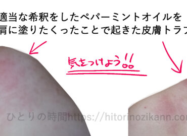 スイートアーモンドオイルとペパーミント精油でアロマイルを適当な希釈をして作ったことで、炎症が起きた話。